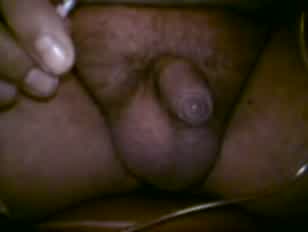 Wwwidinxxx