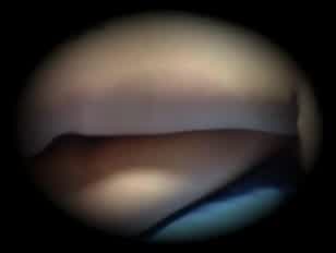 Indian sex vu clips